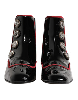 Black Jackie Buttoned Chelsea Boots Shoes